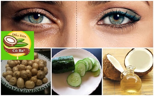Sử dụng dầu dừa, khoai tây và dưa chuột trị thâm quầng mắt